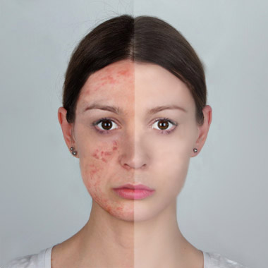Clinical Dermatology